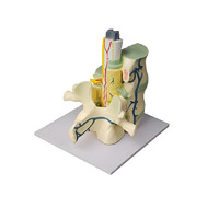 Модель части позвоночника человека - «globural.ru» - Махачкала