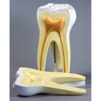 Модель "Строение зуба" - «globural.ru» - Махачкала