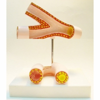 Модель "Здоровые и поврежденные сосуды"	 - «globural.ru» - Махачкала