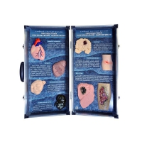 Учебно-демонстрационный кейс "Последствия употребления наркотиков" - «globural.ru» - Махачкала