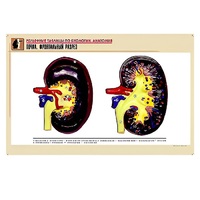 Рельефная таблица "Почка. Фронтальный разрез" (формат А1, матовое ламинир.) - «globural.ru» - Махачкала