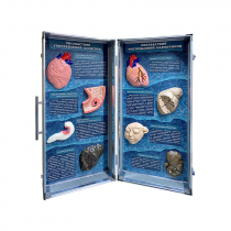 Учебно-демонстрационный кейс "Последствия употребления алкоголя и наркотиков" - «globural.ru» - Махачкала